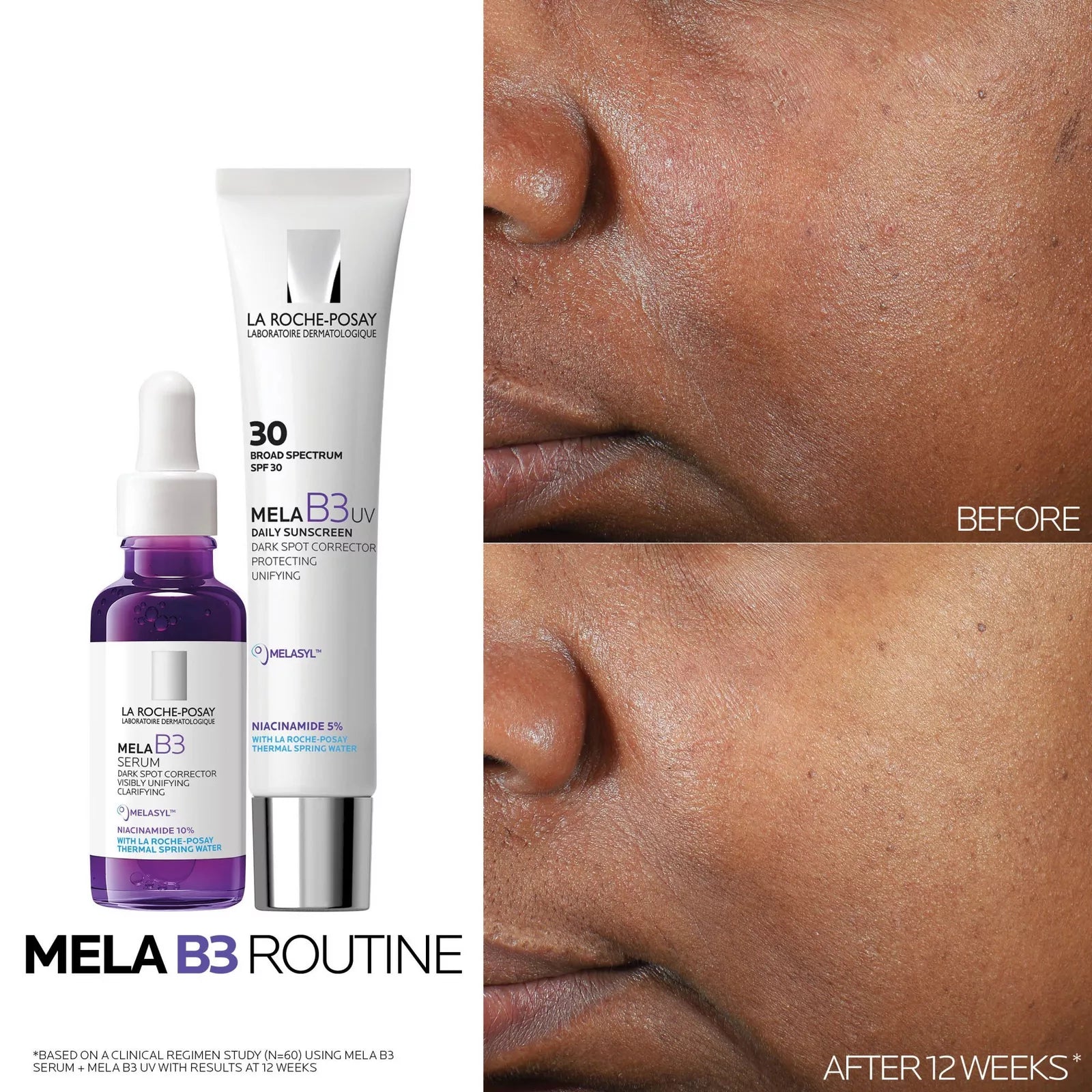 MELA B3 DARK SPOT CORRECTOR SERUM WITH NIACINAMIDE